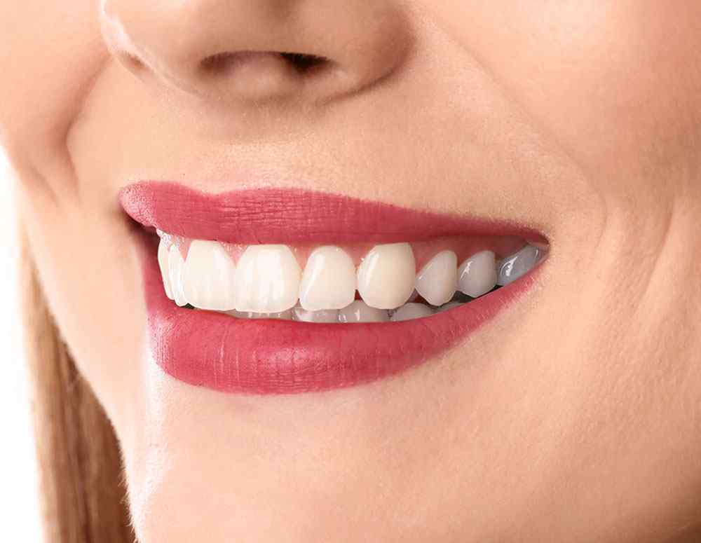 https://aligndentaldwarka.com/wp-content/uploads/2020/02/teeth-after.jpg